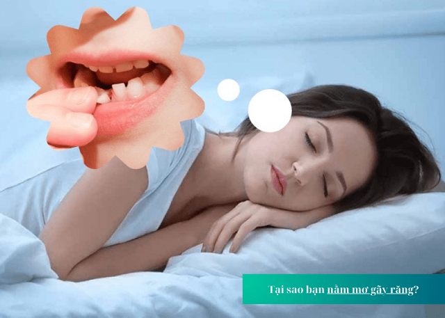 Tìm hiểu nguyên nhân xuất hiện giấc mơ bị rụng răng